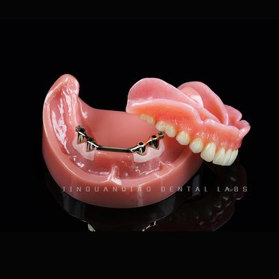 Mua Trung Quốc Phòng thí nghiệm phục hồi vĩnh viễn hoàn chỉnh composite Acrylic răng giả răng CE FDA online manufacture