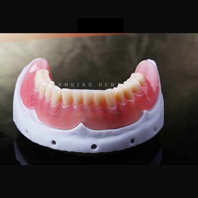 Buy Custom Removable Dentures Complete Acrylic Teeth Precision Titanium Bar China Dental Lab online manufacture