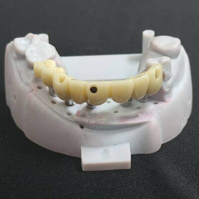 kupować Spersonalizowane prowadnice do implantów dentystycznych i protezy drukowane w technologii 3D Laser Printing z certyfikatami CE FDA online manufacture