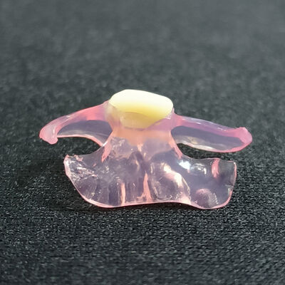 Buy Personalized Customized Valplast Flexible Denture Durable Natural Looking online manufacture