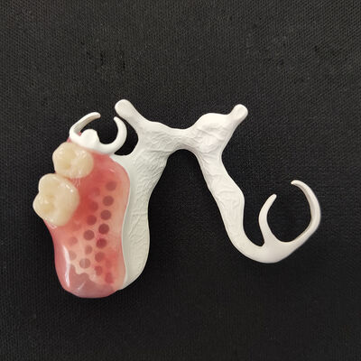 comprare Materiale PEEK Protesi Rimovibili Stampa Laser 3D Personalizzata per un'Ottima Vestibilità Naturale online manufacture