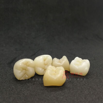 Buy Denture False Teeth PFZ Crowns Bridges Chinese Dental Lab Customized online manufacture