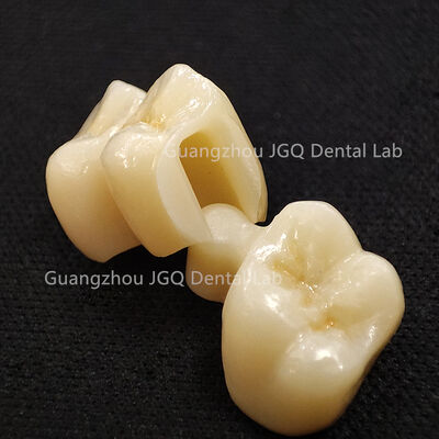 Buy Long Lasting Dental Zirconia Crown Bridge Customized Fast Turnaround online manufacture