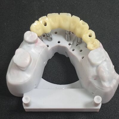 comprare Corona Personalizzata in Zirconia con Stampa Laser 3D per Impianti Dentali Certificata CE FDA online manufacture