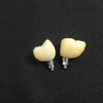 Buy Chinese Dental Lab Teeth Implants 3D Laser Printing Customized online manufacture