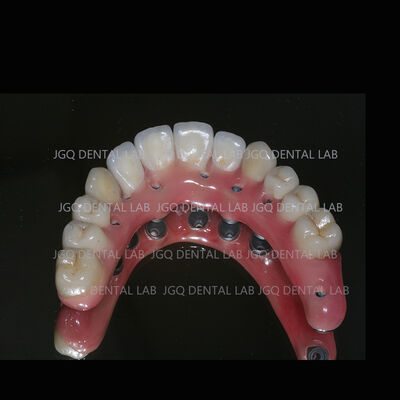 comprar Coroa de Zircônia Monolítica Ponte de Implante de Maxilar Completo Coroa de Implante Cimentada e Ponte online manufacture