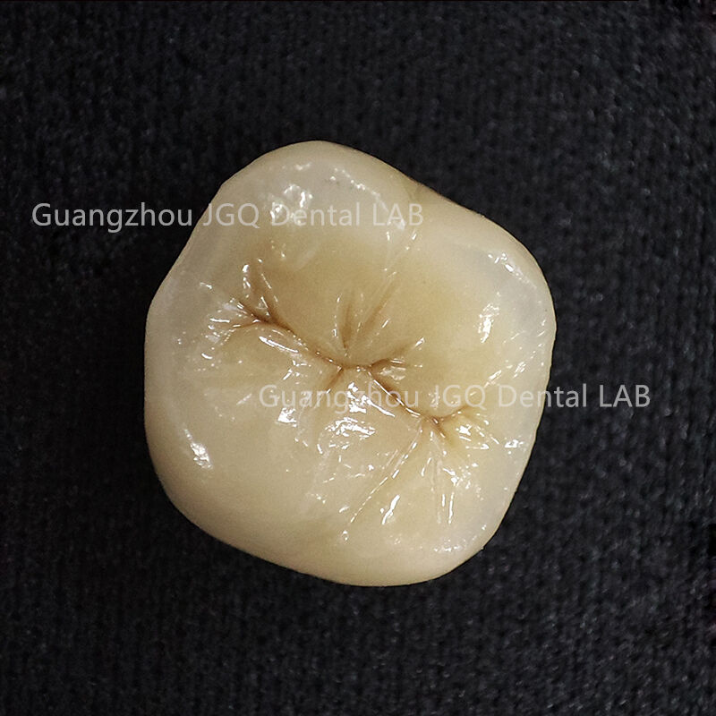 China Dental Lab Full Metal Pfm Crowns and Bridges 3D Digital for ...
